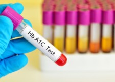 HbA1c tests and other type 1 diabetes health checks