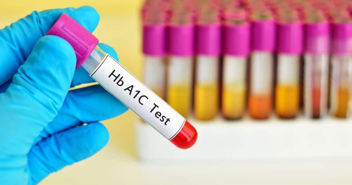 HbA1c tests and other type 1 diabetes health checks