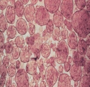 Image is a light microscopy image of islet-like cell clusters, with many pink, irregularly shaped rounded structures. Image courtesy of Professor Wayne Hawthrone 