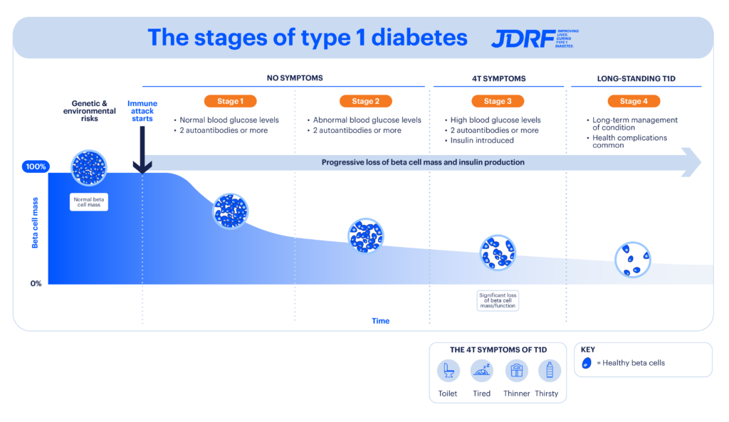 Image shows the four stages of type 1 diabetes from left to right. It represents a stylised graph of beta cell mass or function falling over time as T1D progresses. At each stage there is a stylised image of a cluster of beta cells showing less and less healthy cells as the immune system attacks them. Starting at the left, the image shows that in those without T1D, there is a high level of beta cell mass or function (100%). An arrow facing down represents that in those who are genetically susceptible, environmental triggers start the body’s immune attack on insulin-producing beta cells. The next stage, Stage 1 is to the right and shows the words: ‘normal blood glucose levels’ and ‘2 autoantibodies or more’. The graph associated with Stage 1 shows a significant fall in the beta cell mass. To the right, Stage 2 shows the words: ‘abnormal blood glucose levels’ and ‘2 autoantibodies or more’. The graph shows a bigger fall in beta cell mass. Above Stage 1 and 2 there is a line with the words: ‘no symptoms’. To the right is Stage 3, with further falls in the graph and with the words ‘high blood glucose levels’, ‘2 autoantibodies or more’ and ‘insulin introduced’. Above Stage 3 there are the words: ‘4T symptoms’. Below Stage 3 there is an infographic representing the 4T symptoms associated with this stage with the words ‘toilet’, ‘tired’, ‘thinner’ and ‘thirsty’. The last stage on the right is Stage 4 with the words ‘Long-term management of condition’ and ‘Health complications common’. Above Stage 4 are the words ‘Long-standing T1D’. Across the graph from left to right there is an arrow with the words ‘progressive loss of beta cell mass and insulin production’.